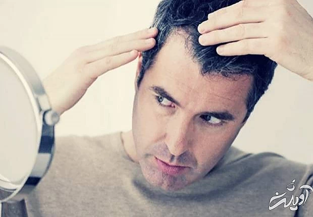 دلایل سفید شدن موی سر  استرس سفیدی مو